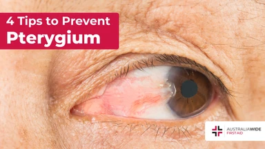 Prevent pterygium article header – First Aid Article in 